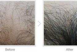 剃阴毛视频,视频教学，轻松掌握私密护理